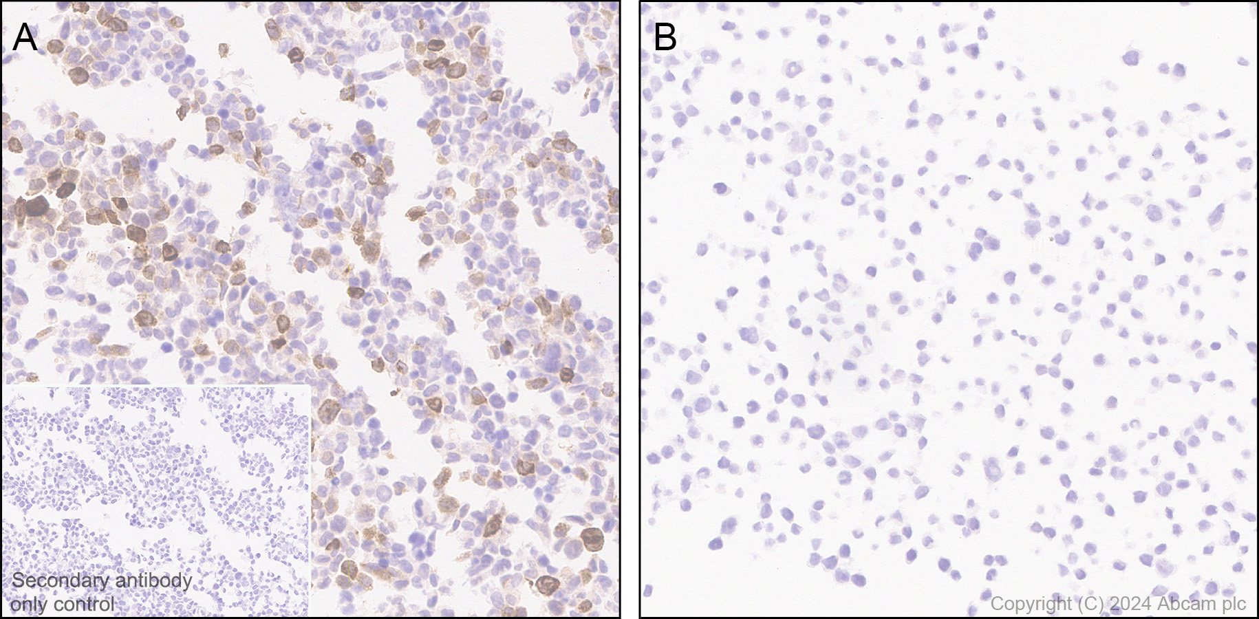 Immunohistochemistry (Formalin/PFA-fixed paraffin-embedded sections) - Anti-MCP1 antibody [EPR21025] - BSA and Azide free (ab242013), expandable thumbnail