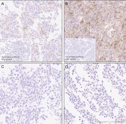 Immunohistochemistry (Formalin/PFA-fixed paraffin-embedded sections) - Anti-MCP1 antibody [EPR21025] - BSA and Azide free (ab242013), expandable thumbnail