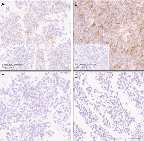 Immunohistochemistry (Formalin/PFA-fixed paraffin-embedded sections) - Anti-MCP1 antibody [EPR21025] - BSA and Azide free (AB242013)