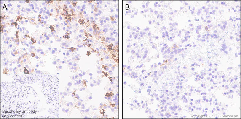 Immunohistochemistry (Formalin/PFA-fixed paraffin-embedded sections) - Anti-MCP1 antibody [EPR27464-89] - BSA and Azide free (AB308523)