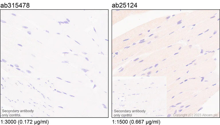 Immunohistochemistry (Formalin/PFA-fixed paraffin-embedded sections) - Anti-MCP1 antibody [RM1100] (AB315478)
