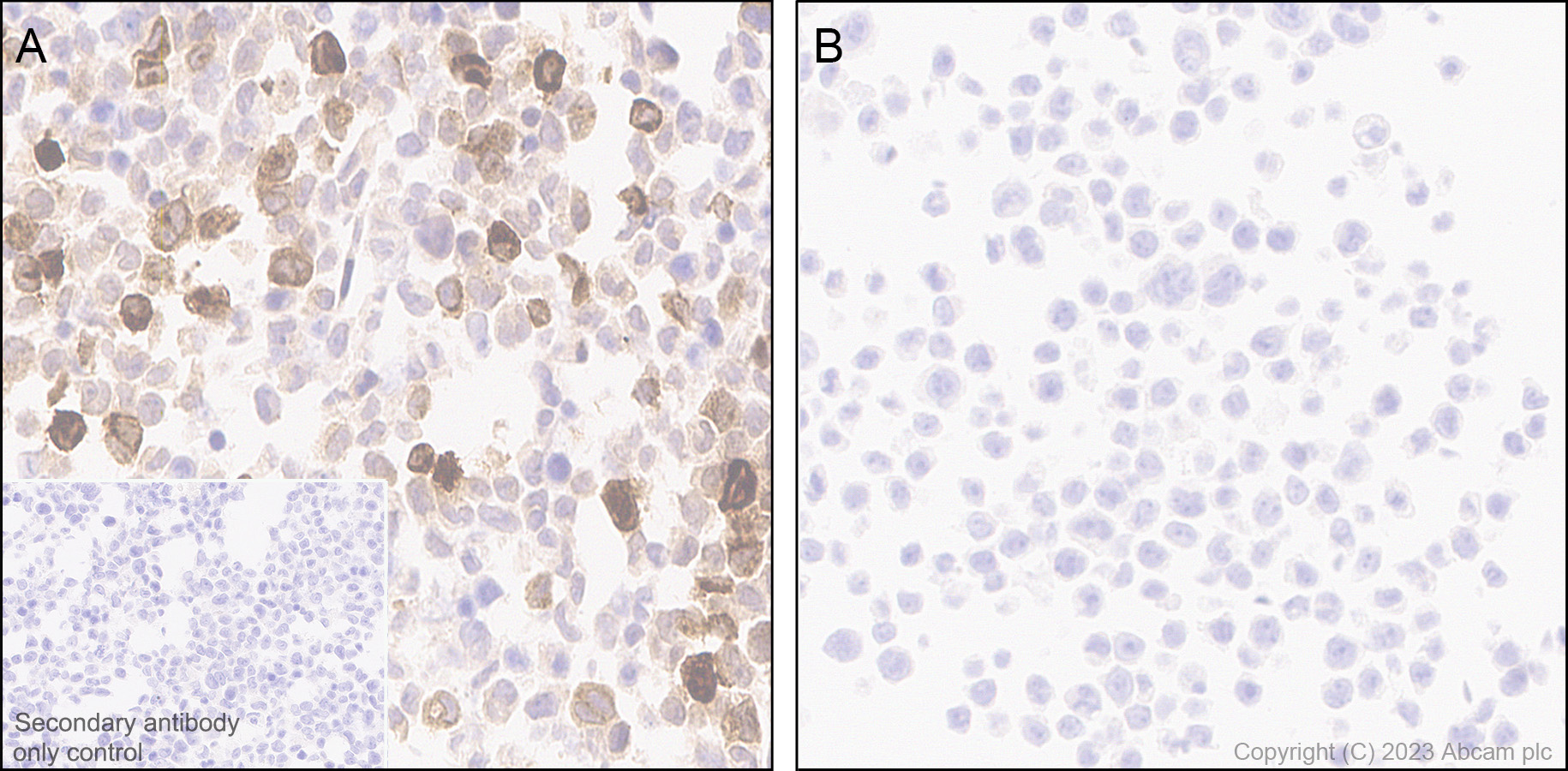 Immunohistochemistry (Formalin/PFA-fixed paraffin-embedded sections) - Anti-MCP1 antibody [RM1100] - BSA and Azide free (ab315479), expandable thumbnail