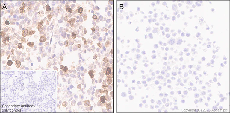 Immunohistochemistry (Formalin/PFA-fixed paraffin-embedded sections) - Anti-MCP1 antibody [RM1100] - BSA and Azide free (AB315479)
