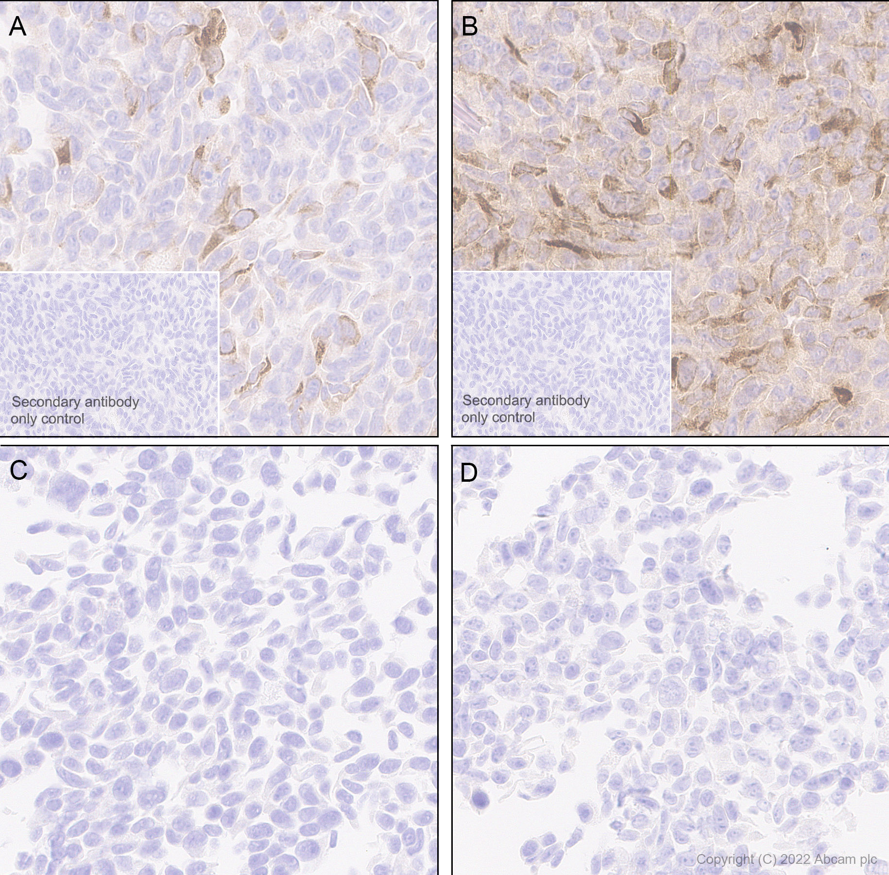 Immunohistochemistry (Formalin/PFA-fixed paraffin-embedded sections) - Anti-MCP1 antibody [RM1100] - BSA and Azide free (ab315479), expandable thumbnail