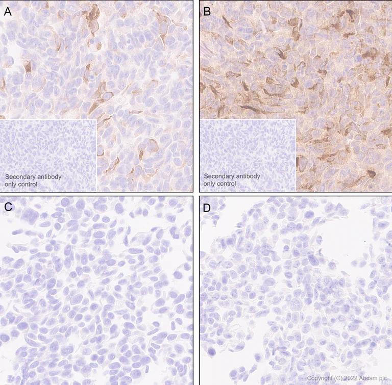 Immunohistochemistry (Formalin/PFA-fixed paraffin-embedded sections) - Anti-MCP1 antibody [RM1100] - BSA and Azide free (AB315479)