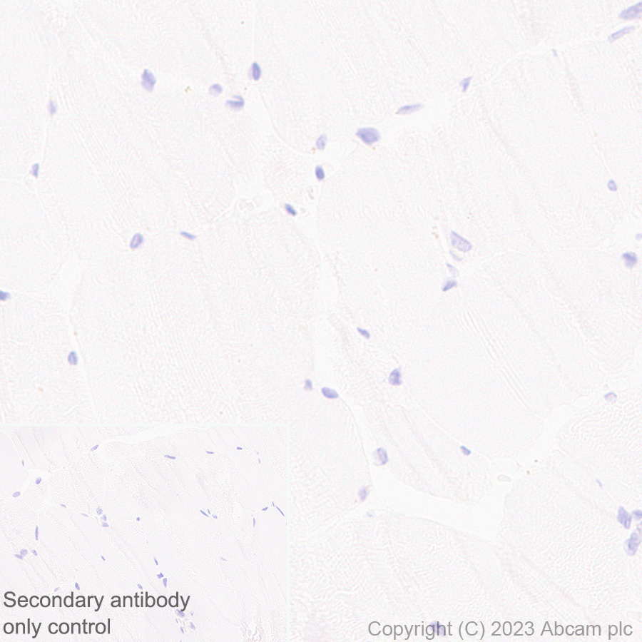 Immunohistochemistry (Formalin/PFA-fixed paraffin-embedded sections) - Anti-MCP1 antibody [RM1100] - BSA and Azide free (ab315479), expandable thumbnail