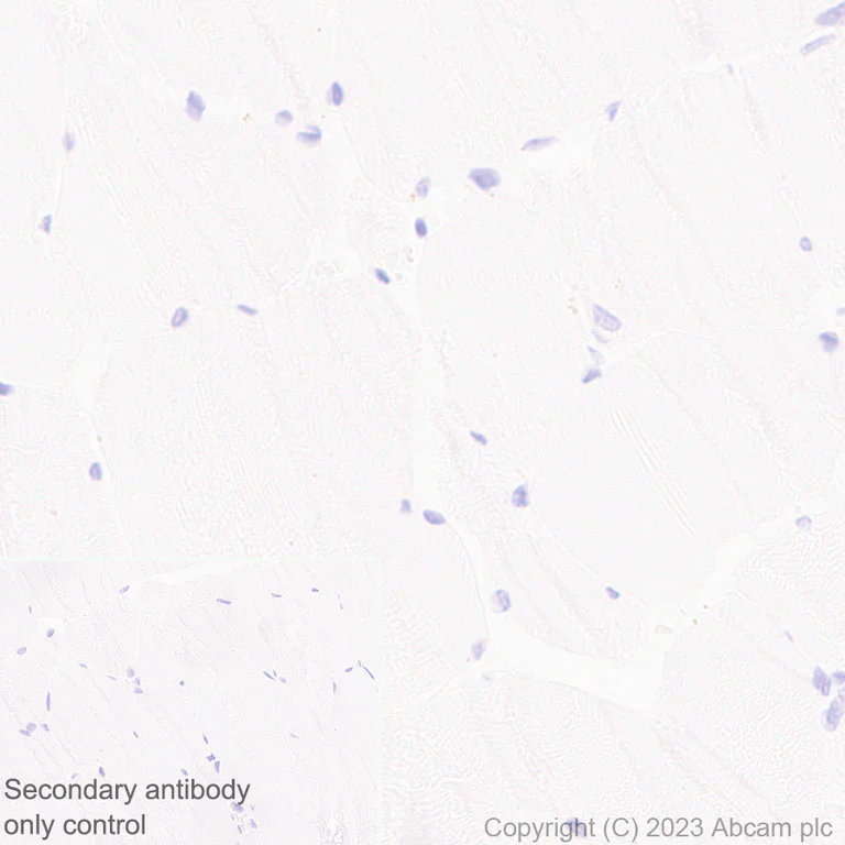 Immunohistochemistry (Formalin/PFA-fixed paraffin-embedded sections) - Anti-MCP1 antibody [RM1100] - BSA and Azide free (AB315479)