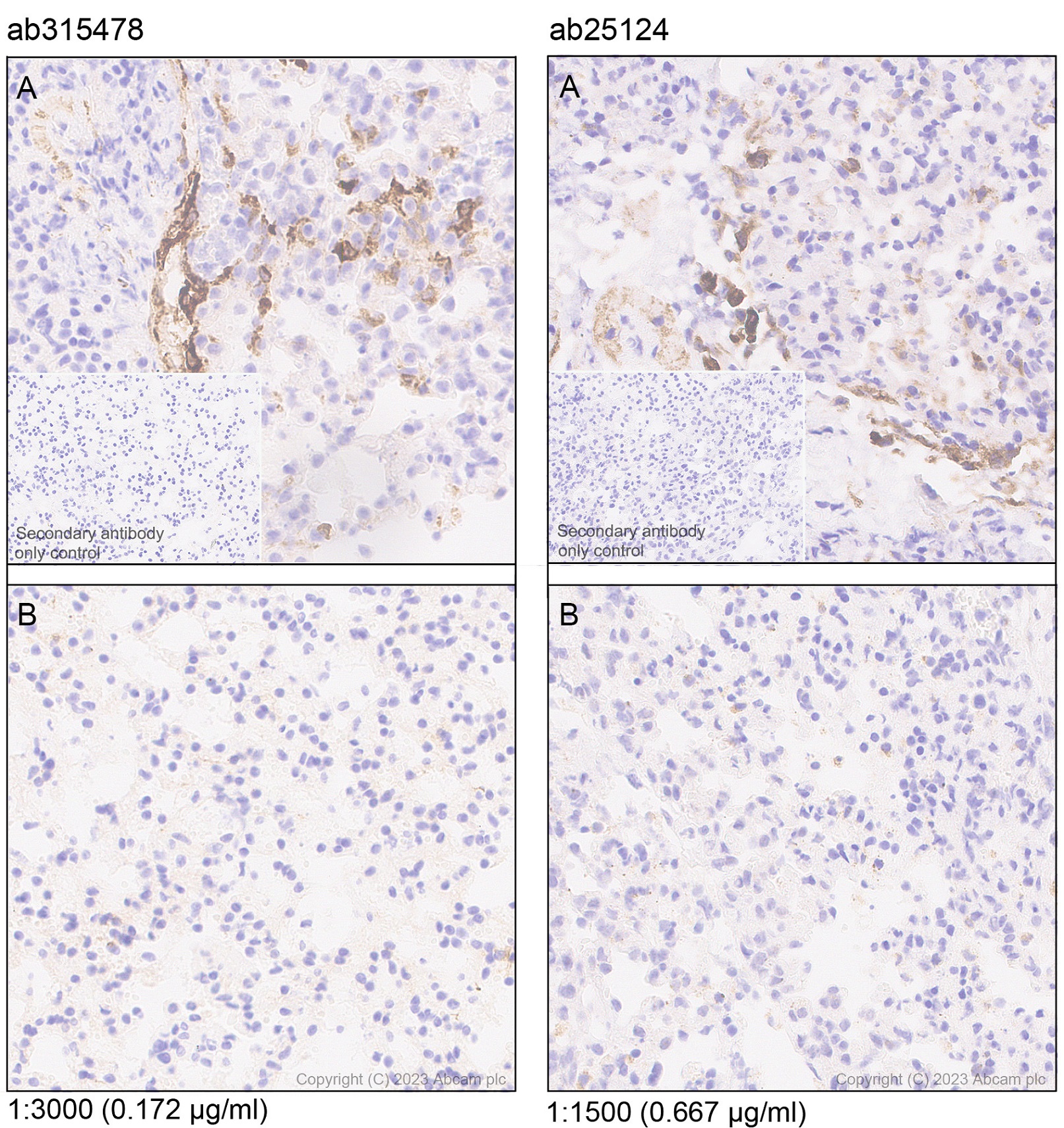 Immunohistochemistry (Formalin/PFA-fixed paraffin-embedded sections) - Anti-MCP1 antibody [RM1100] - BSA and Azide free (ab315479), expandable thumbnail