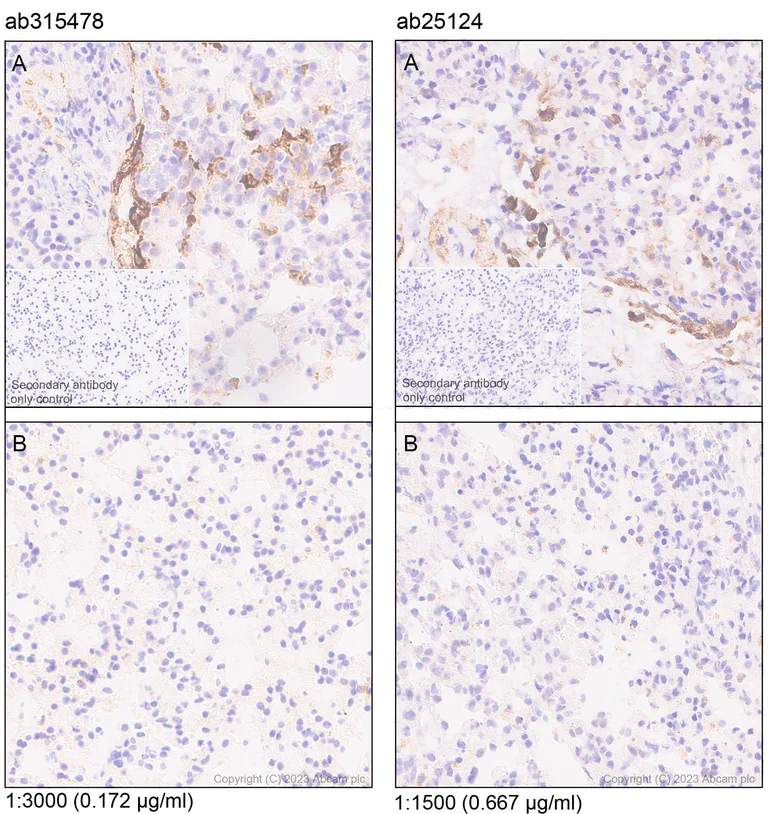 Immunohistochemistry (Formalin/PFA-fixed paraffin-embedded sections) - Anti-MCP1 antibody [RM1100] - BSA and Azide free (AB315479)