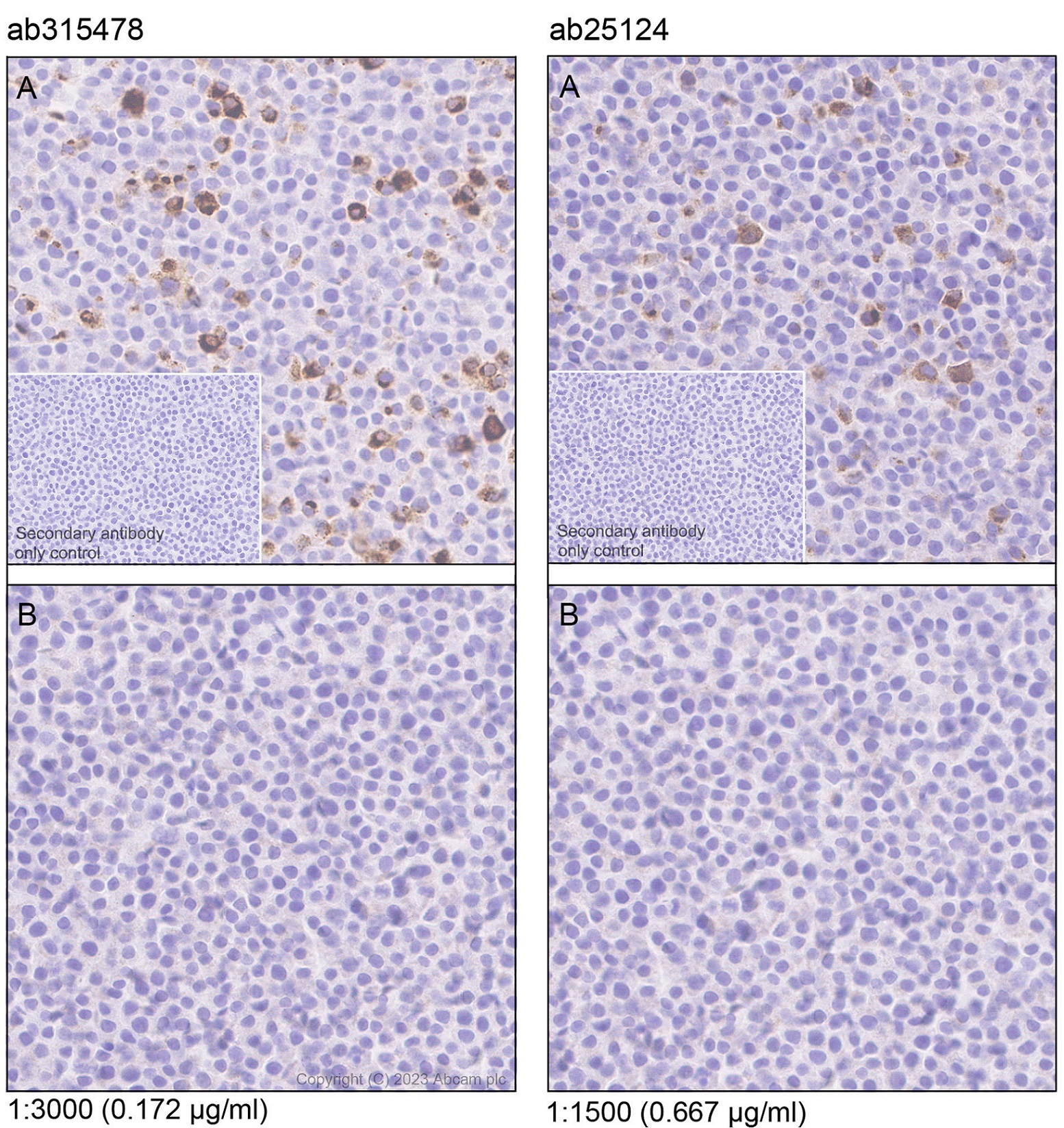Immunohistochemistry (Formalin/PFA-fixed paraffin-embedded sections) - Anti-MCP1 antibody [RM1100] - BSA and Azide free (AB315479), expandable thumbnail