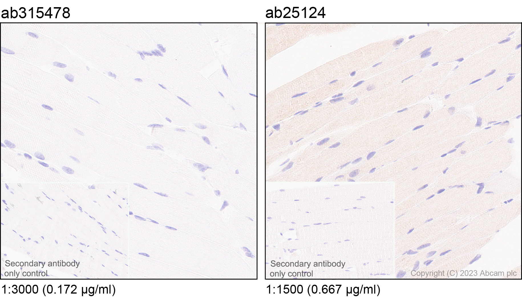 Immunohistochemistry (Formalin/PFA-fixed paraffin-embedded sections) - Anti-MCP1 antibody [RM1100] - BSA and Azide free (ab315479), expandable thumbnail