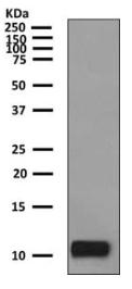 Western blot - Anti-MCP2 antibody [EPR10150] (AB155967)