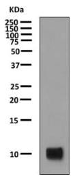 Western blot - Anti-MCP2 antibody [EPR10151] (AB155966)