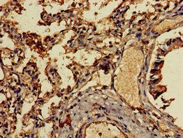 Immunohistochemistry (Formalin/PFA-fixed paraffin-embedded sections) - Anti-MCP4 antibody (AB224593), expandable thumbnail
