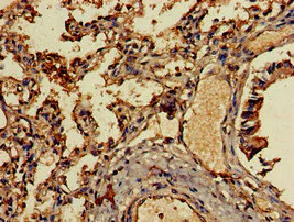 Immunohistochemistry (Formalin/PFA-fixed paraffin-embedded sections) - Anti-MCP4 antibody (AB224593)