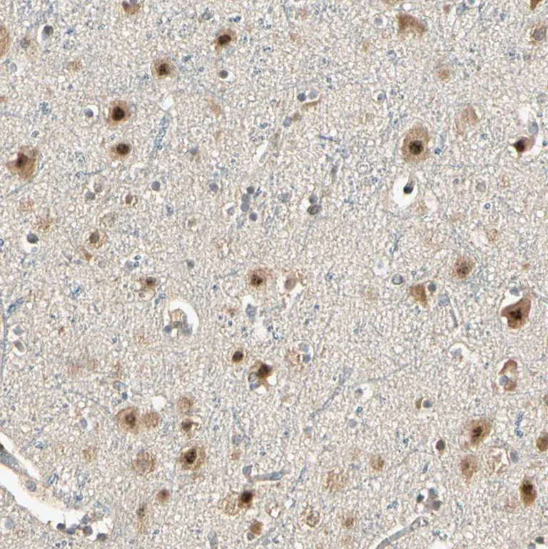 Immunohistochemistry (Formalin/PFA-fixed paraffin-embedded sections) - Anti-MCPH1 antibody (AB121277)