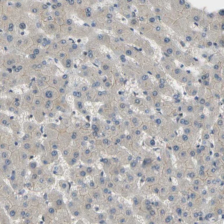 Immunohistochemistry (Formalin/PFA-fixed paraffin-embedded sections) - Anti-MCPH1 antibody (AB121277)