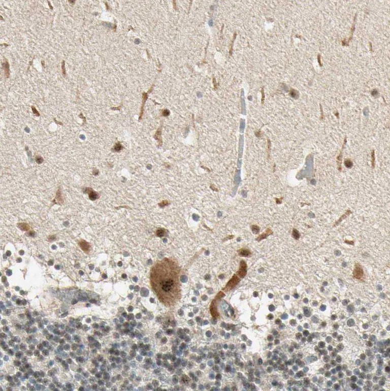 Immunohistochemistry (Formalin/PFA-fixed paraffin-embedded sections) - Anti-MCPH1 antibody (AB121277)