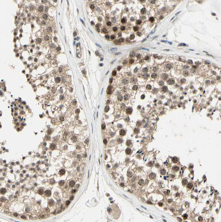 Immunohistochemistry (Formalin/PFA-fixed paraffin-embedded sections) - Anti-MCPH1 antibody (AB121277)