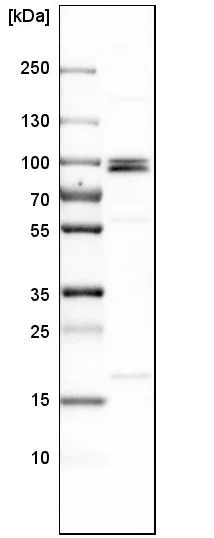 Western blot - Anti-MCPH1 antibody (AB121277)