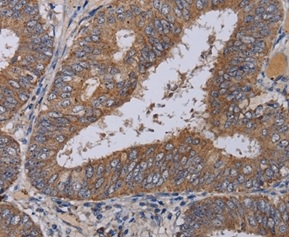 Immunohistochemistry (Formalin/PFA-fixed paraffin-embedded sections) - Anti-MCPIP1 antibody (AB197976)