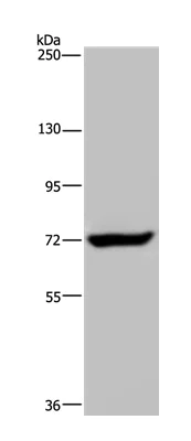 Western blot - Anti-MCPIP1 antibody (AB197976)
