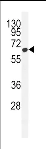 Western blot - Anti-MCPIP1 antibody (AB230502)