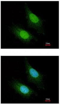 Immunocytochemistry/ Immunofluorescence - Anti-MCPIP1 antibody (AB97910), expandable thumbnail