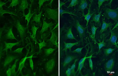 Immunocytochemistry/ Immunofluorescence - Anti-MCPIP1 antibody (AB97910)