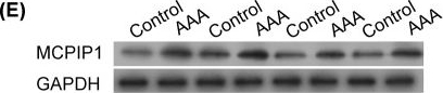 Western blot - Anti-MCPIP1 antibody (AB97910), expandable thumbnail