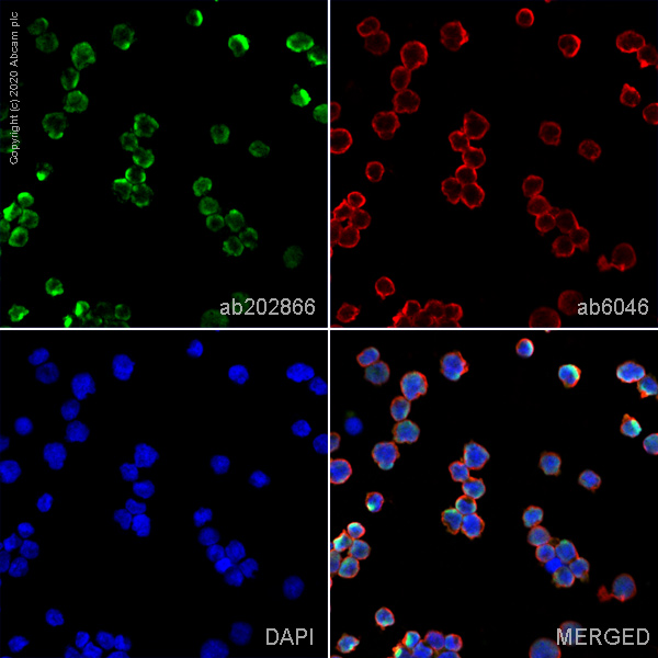 Immunocytochemistry/ Immunofluorescence - Anti-MCPyV_gp3 large T antigen antibody [Ab3] (AB202866), expandable thumbnail