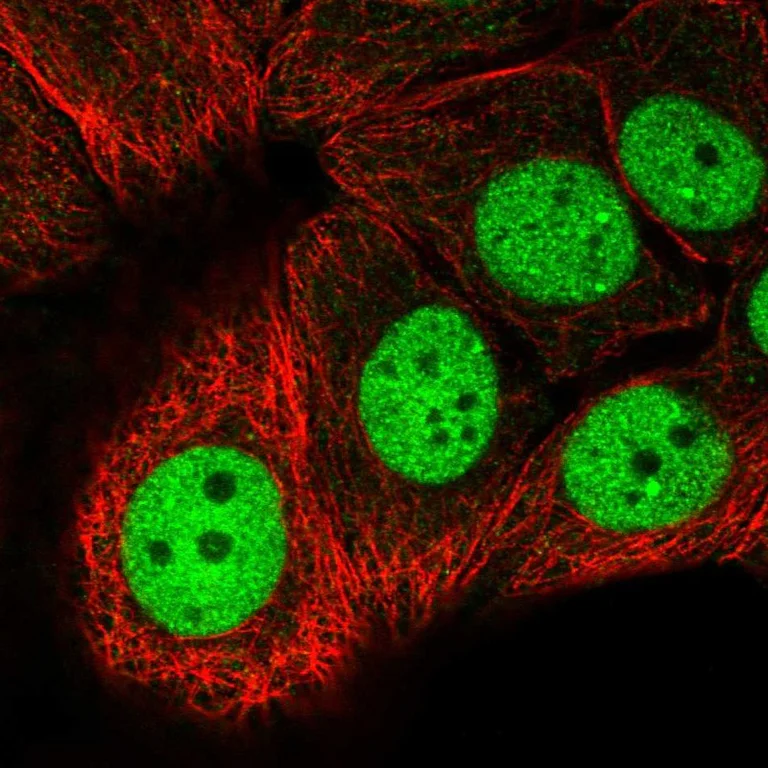 Immunocytochemistry/ Immunofluorescence - Anti-MCRS1/MSP58 antibody (AB247013)