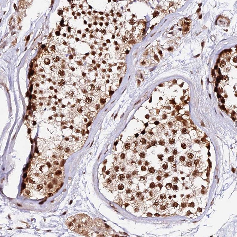 Immunohistochemistry (Formalin/PFA-fixed paraffin-embedded sections) - Anti-MCRS1/MSP58 antibody (AB247013), expandable thumbnail