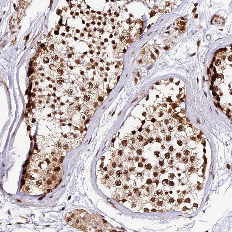 Immunohistochemistry (Formalin/PFA-fixed paraffin-embedded sections) - Anti-MCRS1/MSP58 antibody (AB247013)