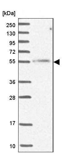 Western blot - Anti-MCRS1/MSP58 antibody (AB247013), expandable thumbnail