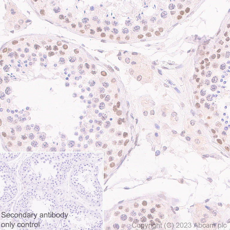 Immunohistochemistry (Formalin/PFA-fixed paraffin-embedded sections) - Anti-MCRS1/MSP58 antibody [EPR27229-81] (AB316109)
