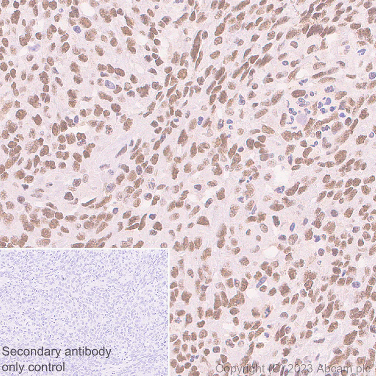 Immunohistochemistry (Formalin/PFA-fixed paraffin-embedded sections) - Anti-MCRS1/MSP58 antibody [EPR27229-81] (AB316109)