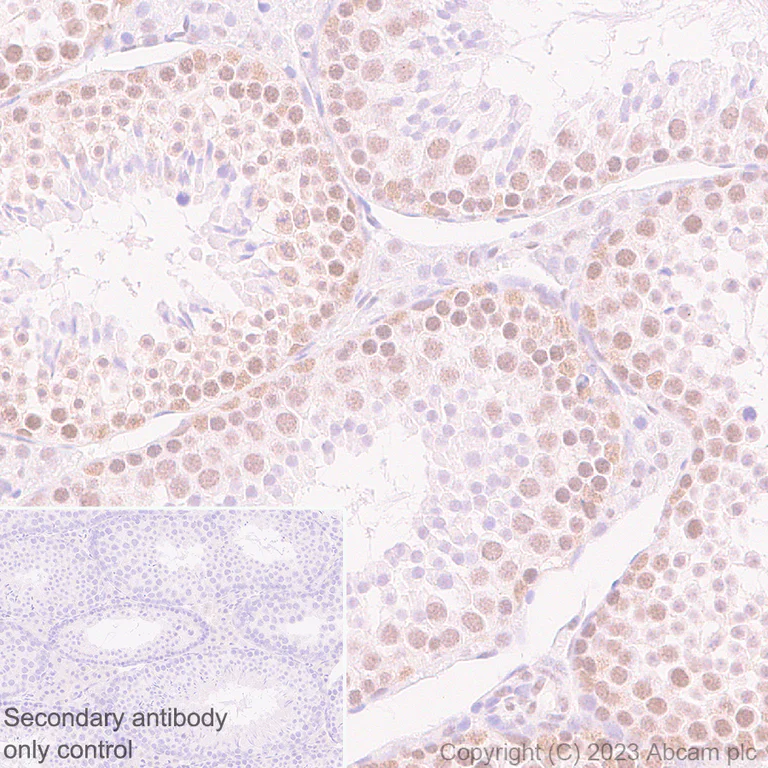 Immunohistochemistry (Formalin/PFA-fixed paraffin-embedded sections) - Anti-MCRS1/MSP58 antibody [EPR27229-81] (AB316109)