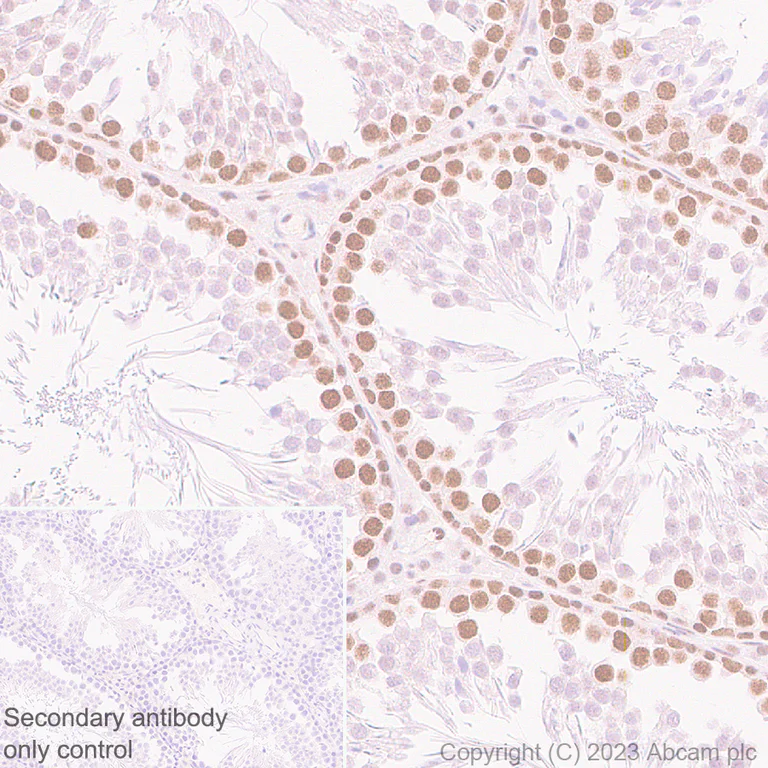 Immunohistochemistry (Formalin/PFA-fixed paraffin-embedded sections) - Anti-MCRS1/MSP58 antibody [EPR27229-81] (AB316109)