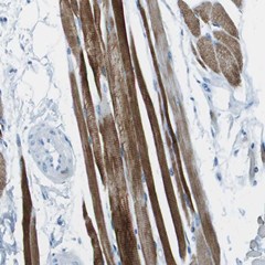 Immunohistochemistry (Formalin/PFA-fixed paraffin-embedded sections) - Anti-MCT 10 antibody (AB121519), expandable thumbnail