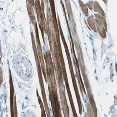 Immunohistochemistry (Formalin/PFA-fixed paraffin-embedded sections) - Anti-MCT 10 antibody (AB121519)