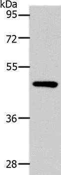 Western blot - Anti-MCT 14 antibody - C-terminal (AB198243)