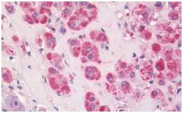 Immunohistochemistry (Formalin/PFA-fixed paraffin-embedded sections) - Anti-MCT 8 antibody (AB192828)