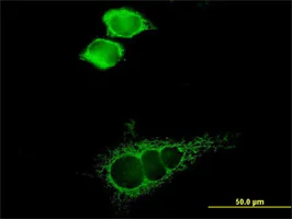 Immunocytochemistry/ Immunofluorescence - Anti-MCT1/Monocarboxylic acid transporter 1 antibody (AB90582)