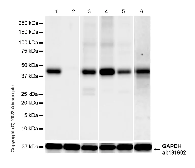 Western blot - Anti-MCT1/Monocarboxylic acid transporter 1 antibody [EPR26702-83] - BSA and Azide free (AB315383)