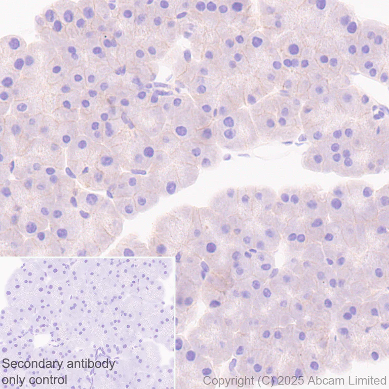 Immunohistochemistry (Formalin/PFA-fixed paraffin-embedded sections) - Anti-MCT1/Monocarboxylic acid transporter 1 antibody [EPR30524-575] (AB324262)