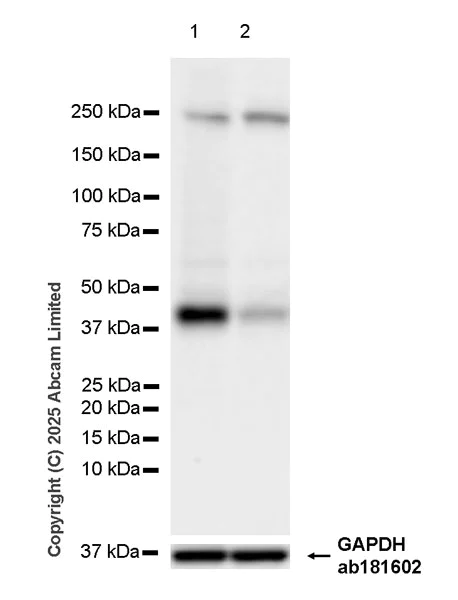 Western blot - Anti-MCT1/Monocarboxylic acid transporter 1 antibody [EPR30524-575] (AB324262)