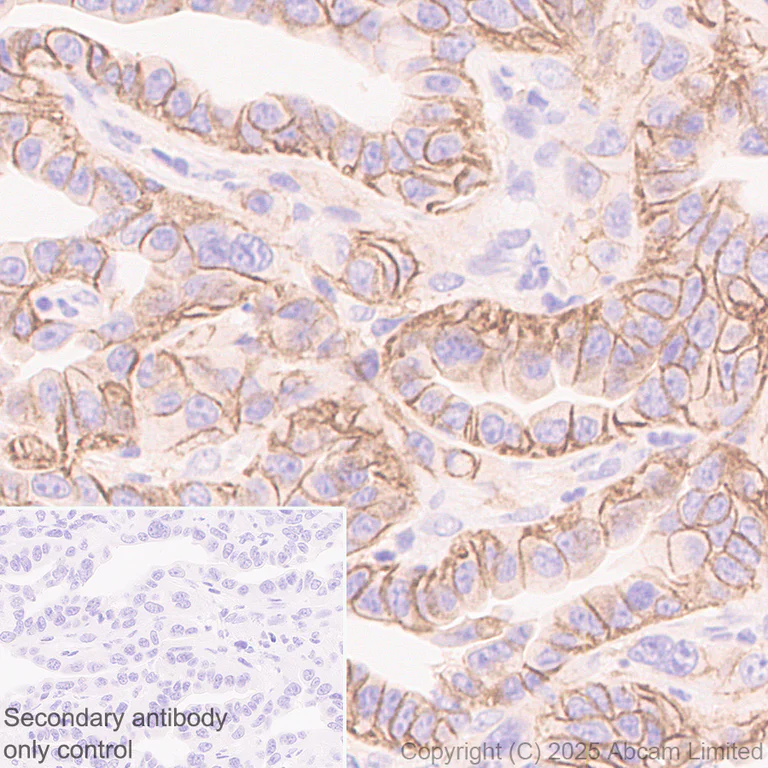 Immunohistochemistry (Formalin/PFA-fixed paraffin-embedded sections) - Anti-MCT1/Monocarboxylic acid transporter 1 antibody [EPR30524-575] - BSA and Azide free (AB324274)