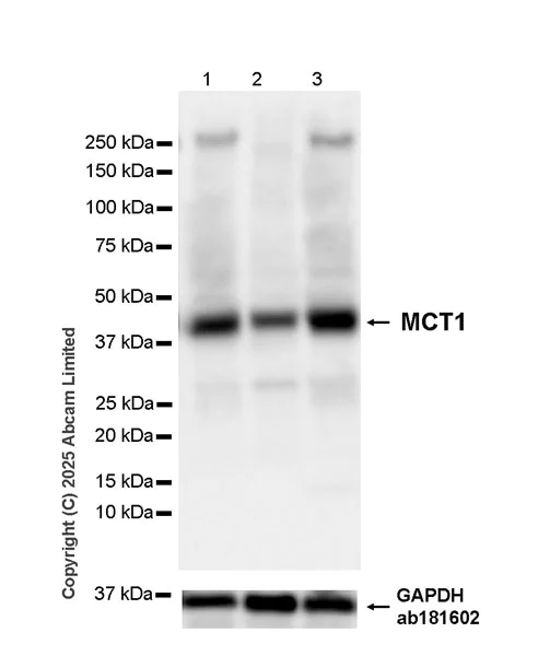Western blot - Anti-MCT1/Monocarboxylic acid transporter 1 antibody [EPR30524-575] - BSA and Azide free (AB324274)