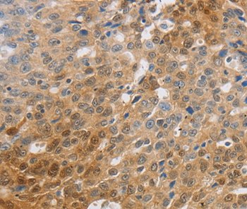 Immunohistochemistry (Formalin/PFA-fixed paraffin-embedded sections) - Anti-MCT2 antibody - C-terminal (AB198272)